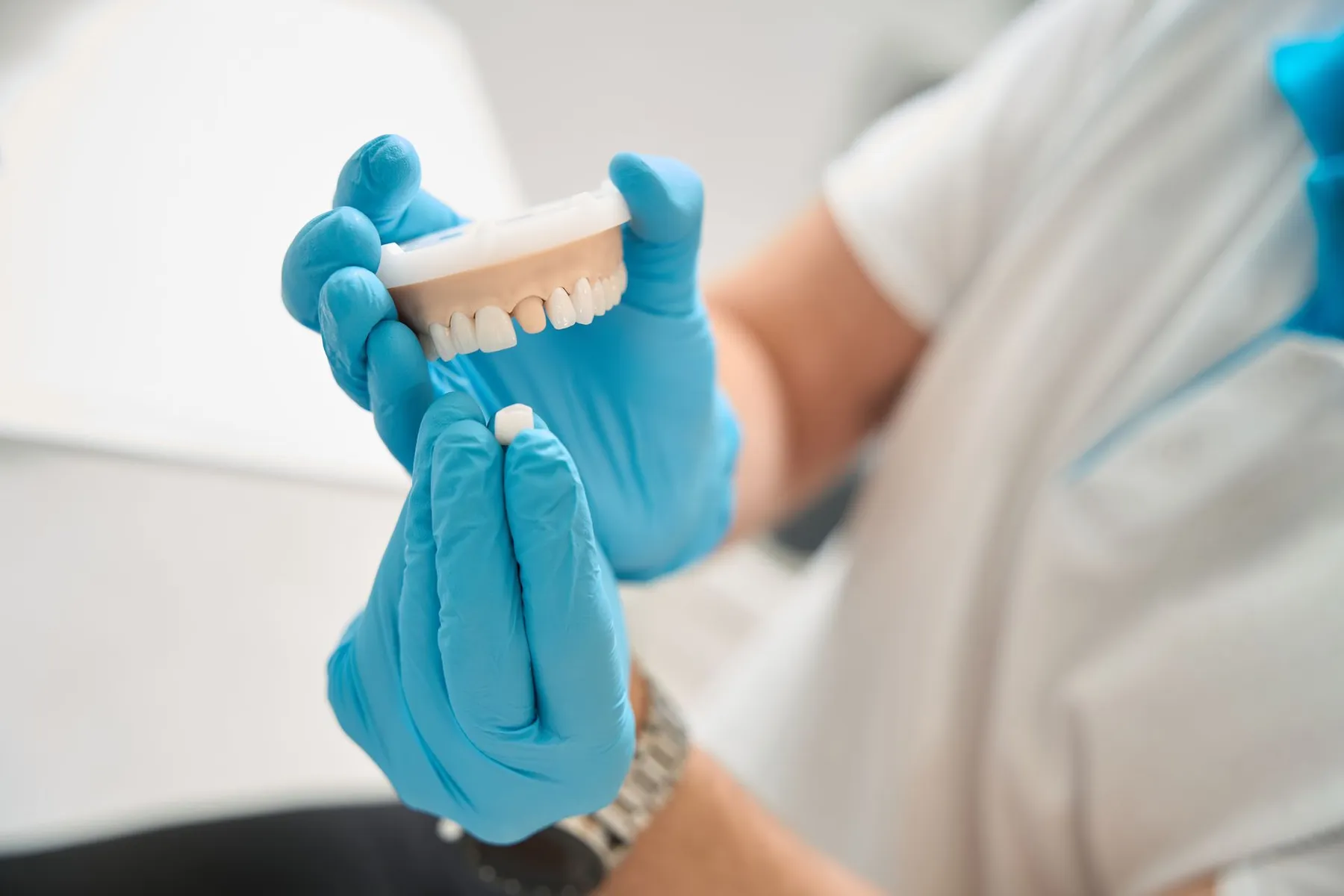 Dentist preparing for procedure, showcasing precise work on a dental crown treatment.