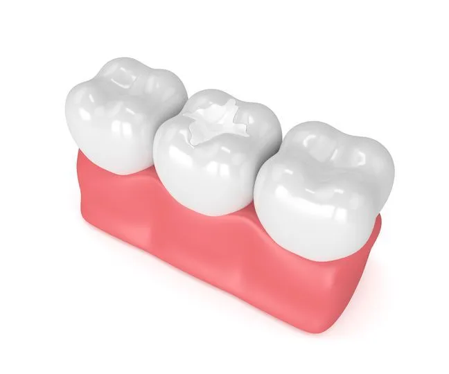 Three white teeth in a row, set in pink gums.