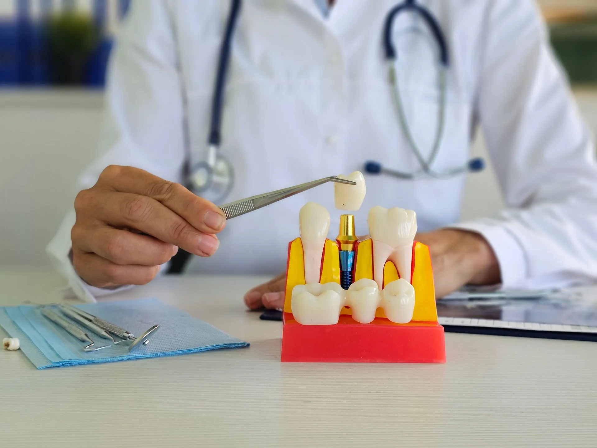 A close-up of a dentist showing a model of human teeth, highlighting a dental implant crown.